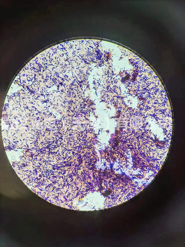 用草莓视频污视频光電草莓视频黄色下载進行芽孢及革蘭氏染色杆菌的觀察